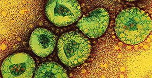 Обнаружен новый вирус, напоминающий вирус атипичной пневмонии …