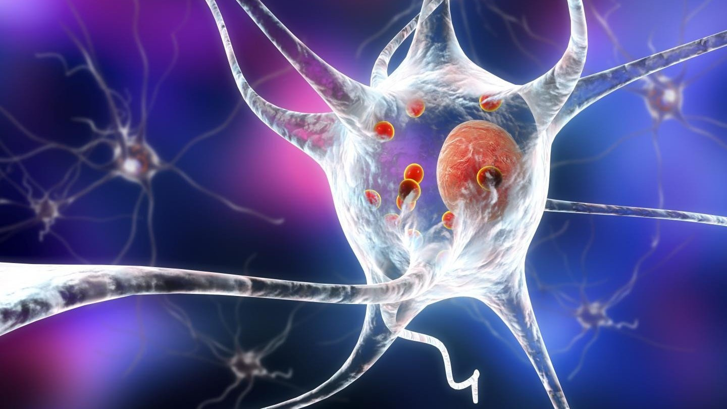 Лечение нанотелами очистит мозг от белковых скоплений при болезни Паркинсона