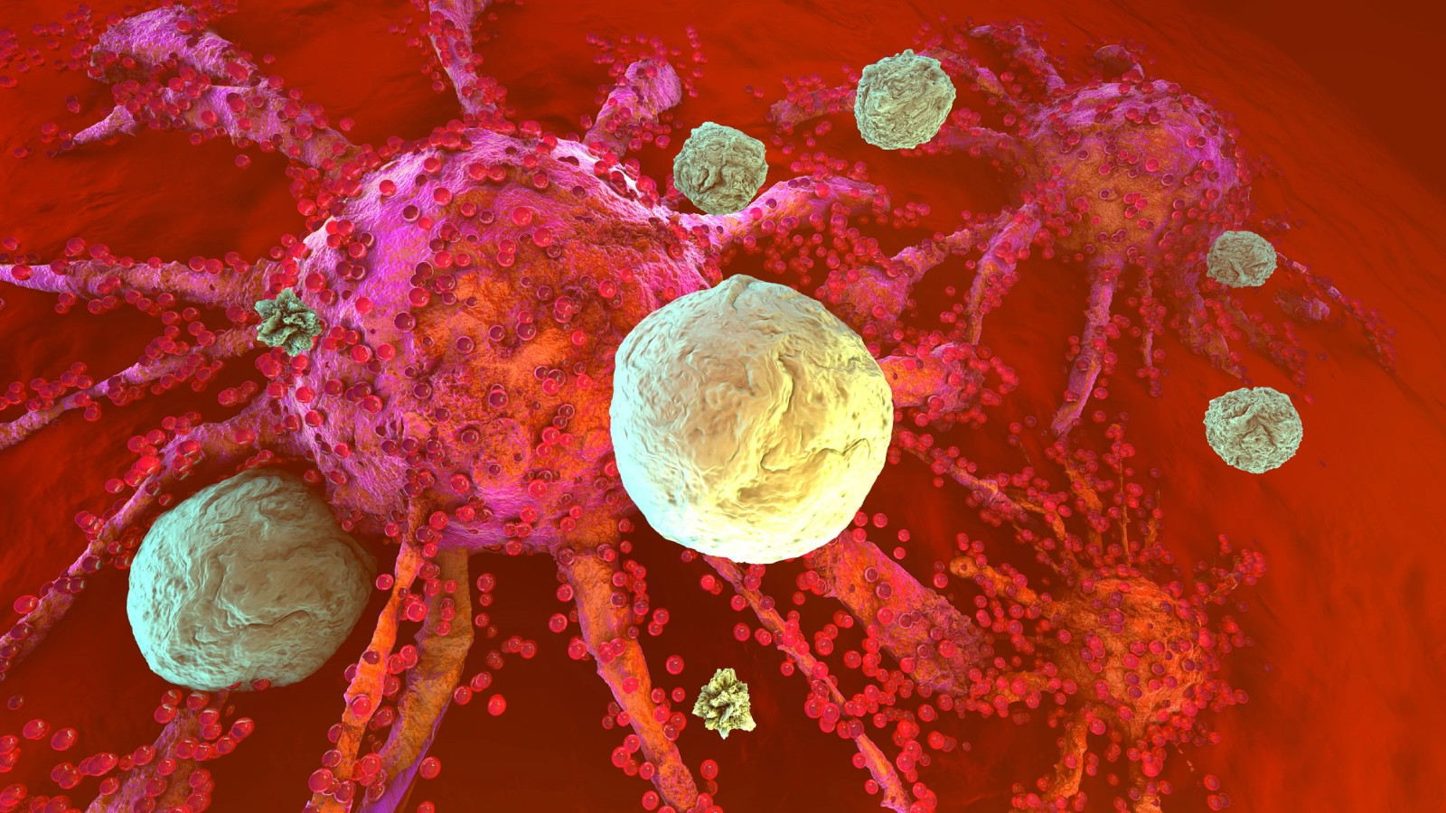 Антигены и иммунотерапия преодолевают барьеры рака поджелудочной железы