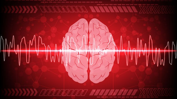ЭЭГ выявляет скрытое сознание у пациентов с травмой мозга