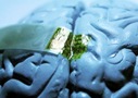 Учёные разрабатывают шёлковый имплантат, который вплавляется в поверхность мозга