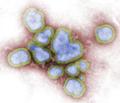 Учёные обнаружили ахиллесову пяту гриппа: Антиоксиданты