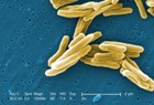 Учёные вырабатывают биотопливо из туберкулёзной бактерии