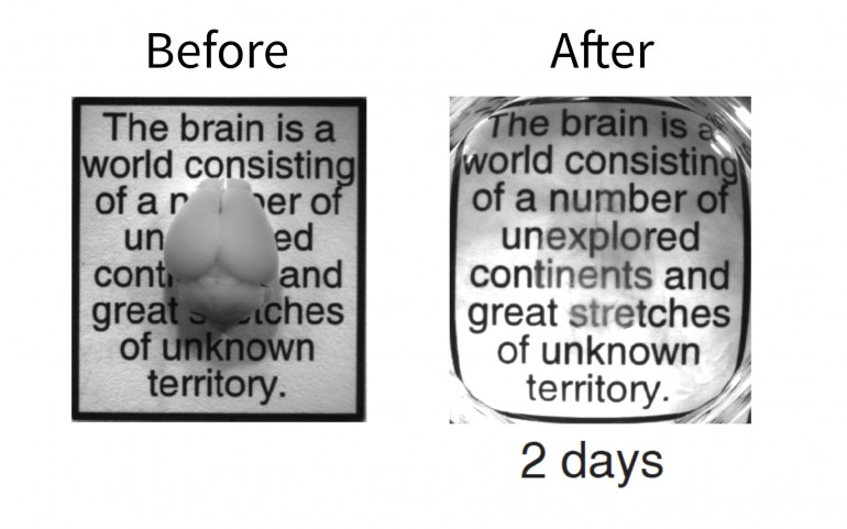Ученые сделали мозг прозрачным