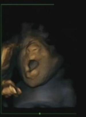 Развивающийся в утробе матери ребёнок умеет зевать