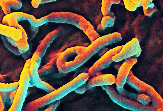 Ученые обнаружили, что вирус Эбола мутирует