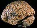 Современные войны отмечены частыми травмами головного мозга