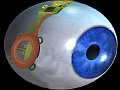 Бионический глаз для потерявших зрение