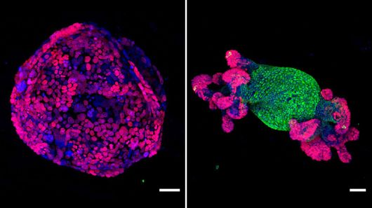 Реактивация одного гена превращает клетки рака в нормальные ткани