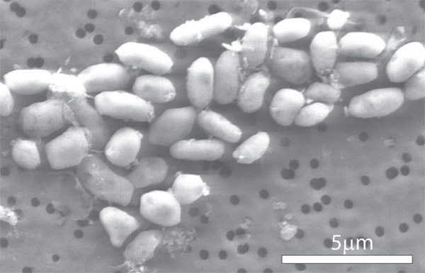 Доказательство найдено: бактерии  GFAJ-1  не могут замещать фосфор на мышьяк