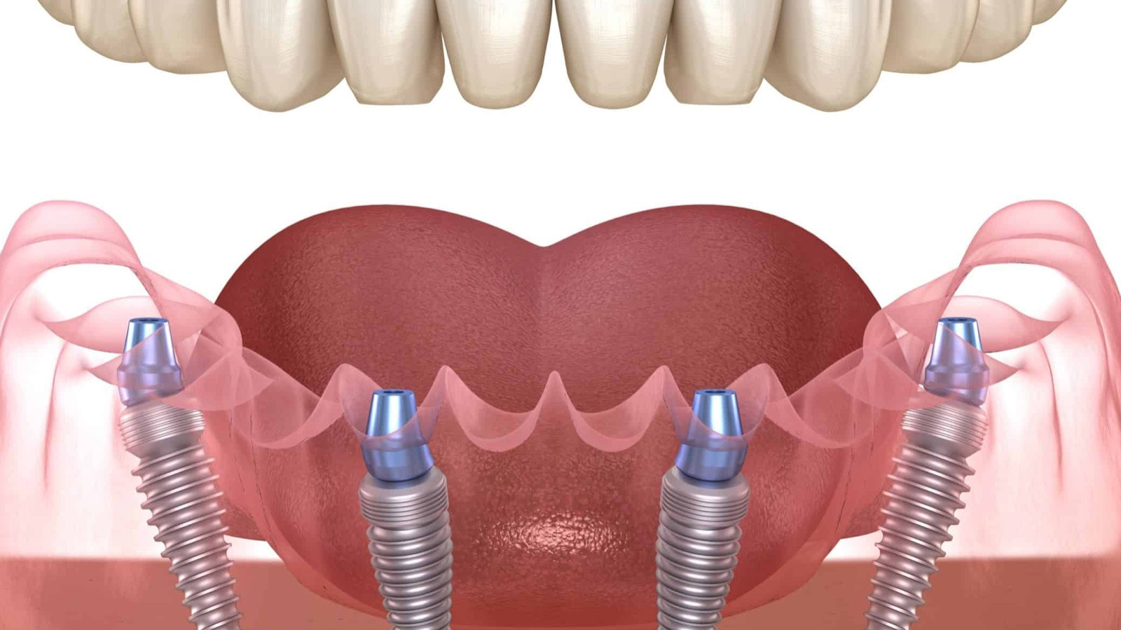 Особенности современной стоматологии